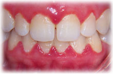 Periodontia